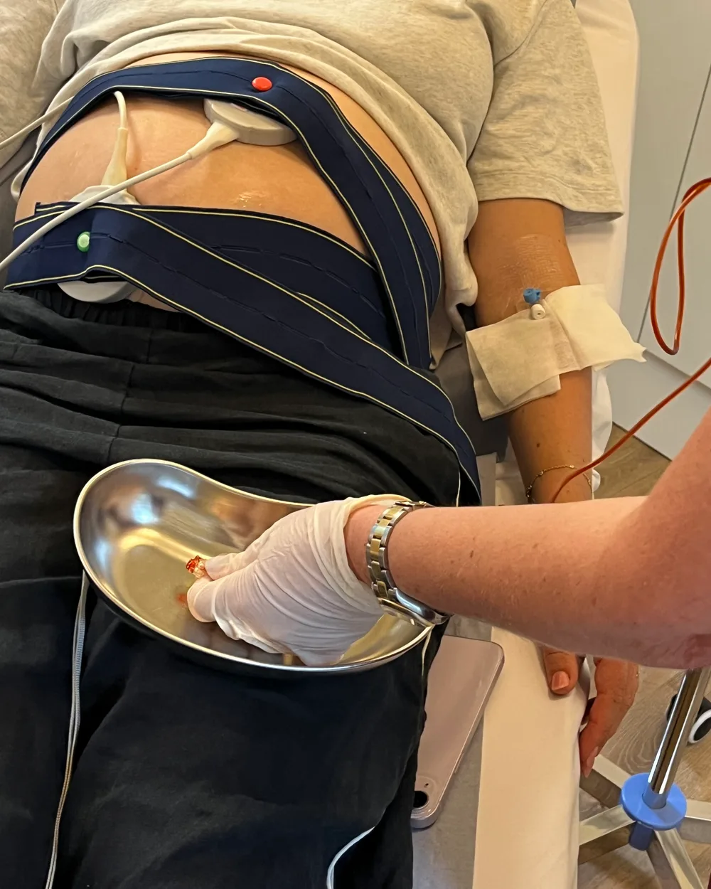 A clinician in gloves working from a sterile kidney dish beside a pregnant patient during an iron infusion at IronOx Clinic Cardiff, with CTG monitoring belts across the bump and a cannula in the forearm